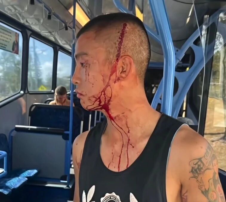 om, 洲头衔卫冕 om, 洲头衔卫冕